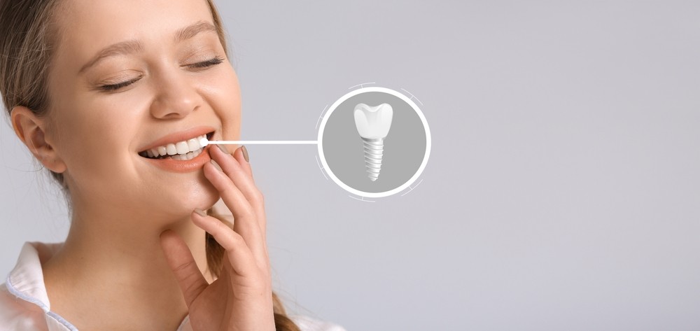 implantologie, implant dentar
